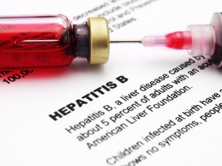 Hepatitis B Virus Hepatitis B Virus